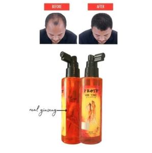 PROTO HAIR TONIC 160ML ORIGINAL - HAIR TONIC GINSENG PROTO 160ML