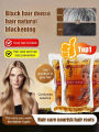 【Darker Hair With Every Wash】Cordyceps Oil-Control Shampoo Cordyceps Repairing Nourishing Shampoo Conditioning Shampoo. 