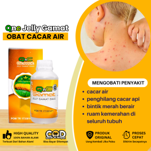 Obat Cacar Air Obat Cacar Air Bayi Dan Dewasa Obat Penghilang Cacar Api Obat Cacar Monyet Obat Gatel Bintik Bintik Berair Obat Ruam Kemerahan Di Seluruh Tubuh Obat Cacar Air Di Punggung Dengan Qnc Jelly Gamat