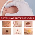 Skin Tag Remover Penghilang Kutil Tanpa Luka Serum Perbaikan Flek Hitam Memudarkan Flek Memutihkan Tanpa Bekas 20ml. 
