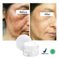 Penghilang Flek Hitam Paling Ampuh BPOM Salep Flek Hitam Ampuh Untuk Menghilangkan Flex Hitam Melasma Salep Flek Melasma Membandel Krim Penghilang Flek Hitam Di Wajah Permanen Cream Flek Khusus Flek Bandel Glowing Cream Leika Penghilang Flek Hitam Melasma. 