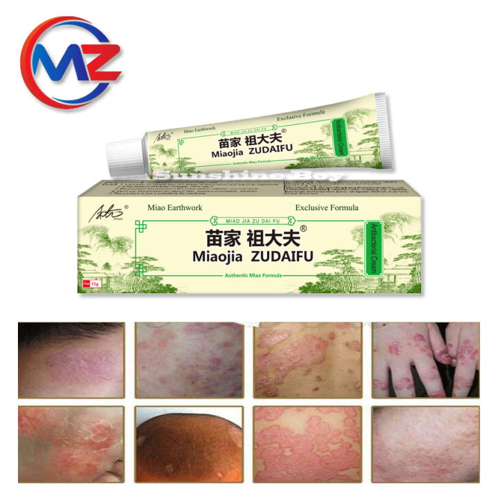 Arturo 15g zudaifu Natural Chinese Herb Herbal Medicine Psoriasis