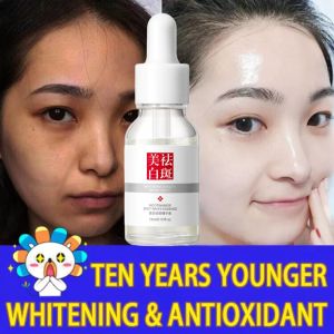Whitening Freckle Serum Remove Dark Spots Anti Freckle Cream Niacinamide Fade Pigmentation Melasma Brighten Creams Day Cream Night Cream Mencerahkan Kulit