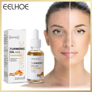 Eelhoe Curcuma Chất Loại Bỏ Vết Thâm S Sửa Chữa Chống-Lão Hóa Làm Giảm Nếp Nhăn Và Nếp Nhăn Và Giữ Ẩm Da Chất Nghệ tàn Nhang Làm Trắng Huyết Thanh Phai Vết Thâm Loại Bỏ Sắc Tố Melanin Sửa Chữa Tinh Chất Chăm Sóc Da Mặt Vẻ Đẹp Chăm Sóc Da Mặt