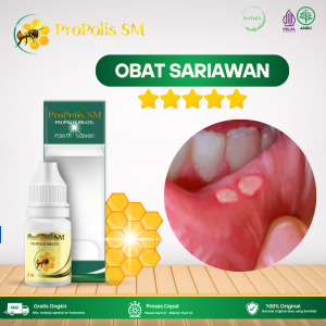 Obat Sariawan Obat Sariawan Di Lidah Obat Sariawan Akut Obat Sariawan Parah Obat Lecet Nyeri Dan Perih Obat Sariawan Di Lidah Sakit Obat Sariawan Berdarah Obat Radang Sariawan Dengan Propolis SM