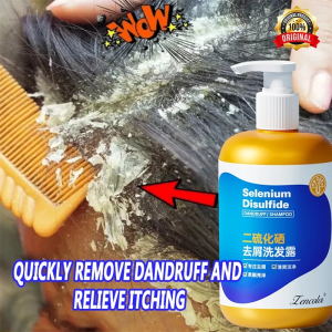 Anti-dandruff shampoo Selenium disulfide shampoo 300ml Shampoo kelemumur Eliminate mites and relieve itching oil control selenium sulfide repair dryness