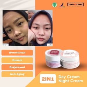 Yonglow Skincare Paket 2in1 Night Cream Krim Malam Day Cream Krim Siang Resmi BPOM Formulasi dr Yong Pemutih Kulit Wajah Penghilang Beruntusan Bekas Jerawat Wajah Pembersih Muka Ampuh