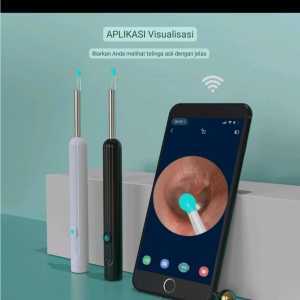 H88 Korek kuping LED camera smart pembersih telinga wireless bayi