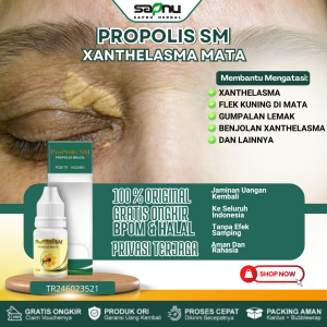 Obat Xanthelasma Mata Obat Penghilang Xanthelasma Obat Penghilang Gumpalan lemak Di Kelopak Mata Obat Penghilang Plak Kuning Mata Obat Pembersih Gumpalan Lemak Obat Benjolan Xanthelasma Obat Benjolan Kecil Di Sekitar Area Mata Dengan Propolis SM
