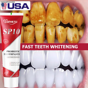 SP10 Probiotic Toothpaste Protection Fresh Breath Remove Stains Teeth Whitening Removes Yellowing And Stains Oral Care