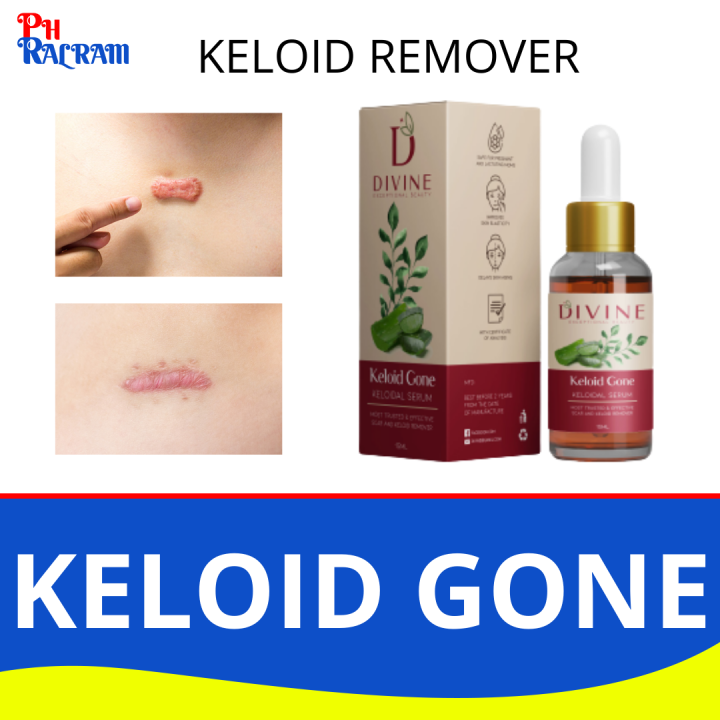 DIVINE EXCEPTIONAL BEAUTY 100% Organic Keloid Gone | Keloidal Serum | Keloid Remover | Keloidal Removal KELOID GONE | KELOID REMOVER | keloids scar remover for old scar on legs , scar remover , keloid scar remover original , keloids removal original , kel