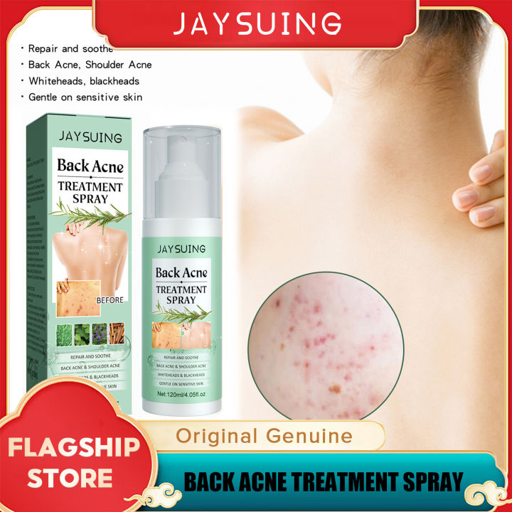 Jaysuing Back Acne Treatment Spray Removal Scar Pimple Acne Repair Oil