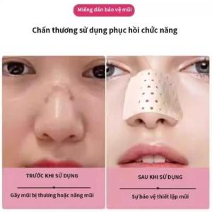 Miếng Nẹp Nâng Mũi Định Hình – Combo 2 Miếng Dụng Cụ Nâng Cao Sống Mũi Kẹp Thu Gọn Cánh Mũi Tại Nhà