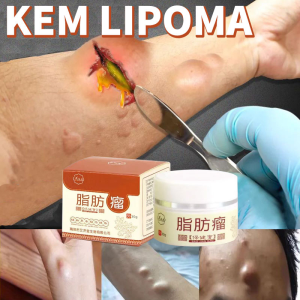 Kem lipoma Loại bỏ mỡ dưới da 30g Tinh chất thảo mộc tự nhiên Giảm đau thần kinh gân