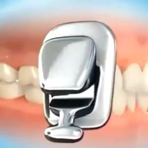 20pcs/Dental Lingual Brackets Orthodontic Self-Ligating Metal Lingual Braces Lingual Retainer0.018 Slot For Dentist Use