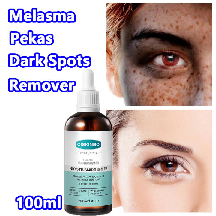 Melasma and pekas remover original serum melasma removal bleaching