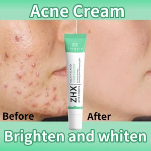 ZHENXIU Acne gel salicylic acid repairing acne cream Deep cleaning absorb excess oil Repair skin to be smoother 20g