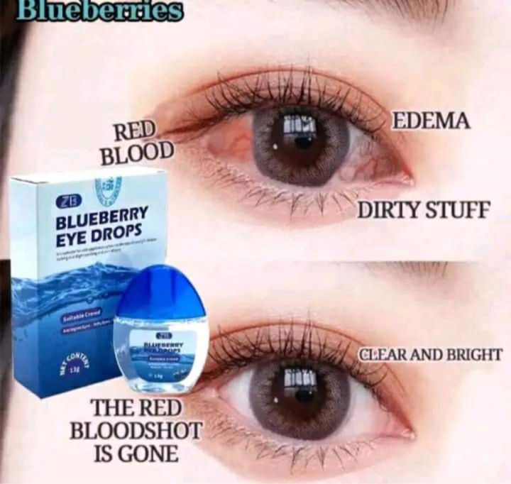 Original Blueberries Eye Drops for Clear Vision Dry Eyes Congestion