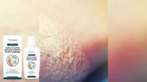 Foot Exfoliating Lotion Gentle Dead Skin Removal + Deep Moisturizing Natural AHA + Botanicals Smooth Feet No Cracks Family-Safe Formula