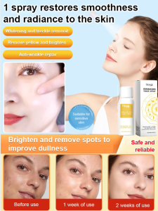 【Sensitive Skin Friendly Moisturizer】 Skin Care Spray Moisturizing Nourishing Facial Spray Soothing Moisturizing Fine Mist