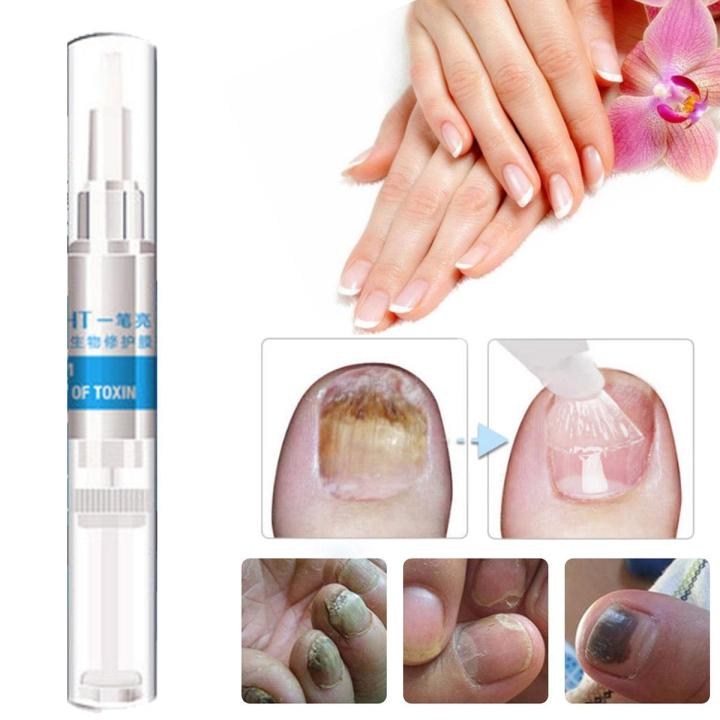 these ingredients found in toenail fungus treatment help save your nails