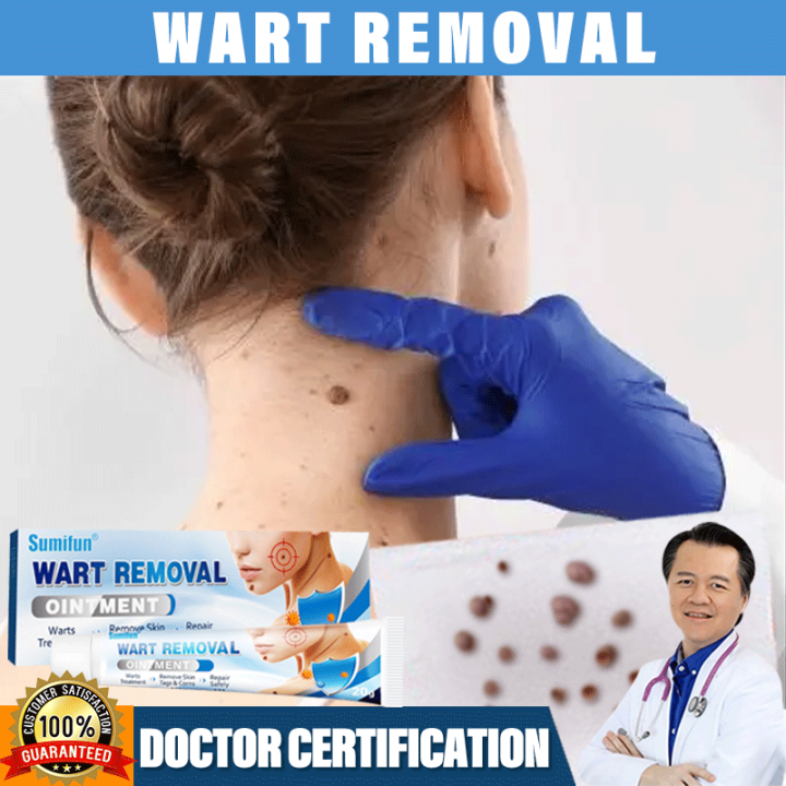 Warts Remover Original Watson Warts Removal Skin Tags And Warts Remover ...