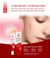 Kem Mờ Sẹo REVITAL 30g, Mờ Sẹo Lòi, Sẹo Thâm, Nám, Giúp Dịu Da Cho Làn Da Sáng Mịn, Hồng Hào. 