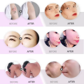 2in1 Pico Laser Plus Diode Picosecond Laser Tattoo Removal Q Switched Nd Yag Laser 755 808 1064nm Hair Removal. 