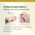[ FOOTSPA SCRUB SET ] Greenika FootSpa Essentials Gift Set – Foot Soak, Scrub, Lotion, Cream & DeoFoot Spray, Complete Foot Care Kit for Dry Skin & Cracked Heels, Moisturizing & Refreshing Spa Set for Men & Women. 