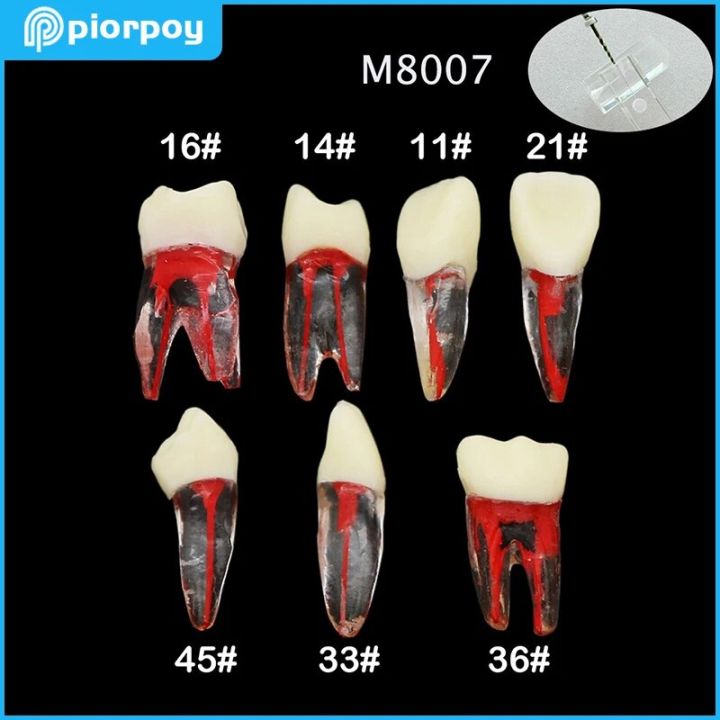 Rotatry Files Rct 【Trending Now】 Endo Training Root Canal Model Rotary Files Rct ...