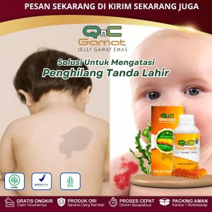 Obat Penghilang Tanda Lahir Hemangioma Tanda Lahir Merah Menonjol Pada Bayi Tanda Lahir Hitam Cokelat Menghilangkan Tanda Lahir di Wajah Tompel Bercak Mongol Pembersih Tanda Lahir Anak Dengan Qnc Jelly Gamat