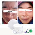 Penghilang Flek Hitam Paling Ampuh BPOM Salep Flek Hitam Ampuh Untuk Menghilangkan Flex Hitam Melasma Salep Flek Melasma Membandel Krim Penghilang Flek Hitam Di Wajah Permanen Cream Flek Khusus Flek Bandel Glowing Cream Leika Penghilang Flek Hitam Melasma. 