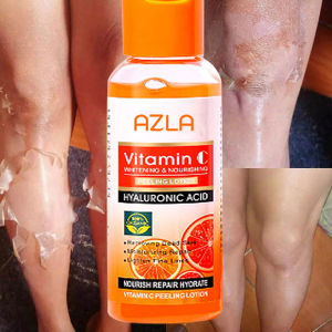 AZLA Vitamin C Peeling Lotion Remove Dead Skin Exfoliating Whitening and Smoothing New Skin Body Skincare Product VC pampalabas na losyon 100ml
