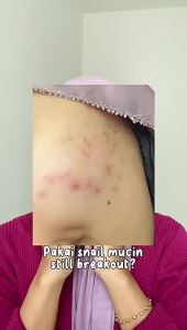 Mixsoon Bean Essence สาระสำคัญ 50ml