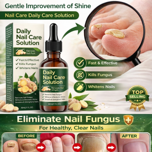 SOUTH MOON Nail Care Solution Nail Fungal Liquid Care Treatment Foot Fungus Repair Essence Paronychia Repair Ingrown Toenail Nail Repair Essence 指甲护理液