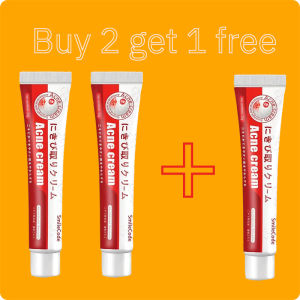 Acne and pimple remover Anti-freckle remove cream whtiening freckle cream to remove marks acne cream