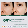 NPURE Dark Spot Cica / Brightening Spot Treatment / Bekas Jerawat / Flek Hitam. 