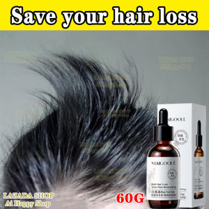 Fast hair growth hair loss serum hair Anti -hair loss oil tonic powerful hair ori 60g man hair loss care m-shaped stay up Hair loss for man and women