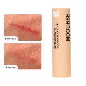 MAKERVY 60% Silicone Silicone Scar Stick Velvety Film Thick Solid Scar Solutions Stick Professional Vitamin E Infused Scar Treatment Stick Scar Treatment Skin Recovery