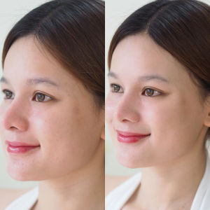 บีบีครีมสูตรออร์แกนิค G&T ORGANIC BB Smooth Sunscreen SPF 50PA+++ คุมมัน เกลี่ยง่าย สบายผิว ปกปิดรอยสิว