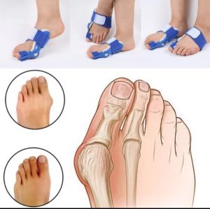 Techlove Bunion Corrector Adjustable Pelurus Jempol Alat Korektor Jempol Kaki IFN