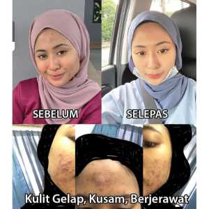 PEMUTIH KULIT SELURUH BADAN SET {30 CAPSULE}FELLE WHITE MEMUTIHKAN KULIT KUSAM JERAWAT JERAGAT‼️‼️‼️