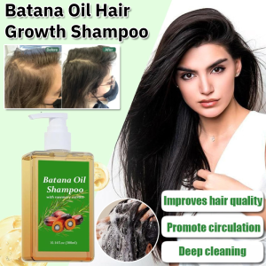 Hair Growth Shampoo Strengthens Hair Roots Anti Hair Loss Shampoo Anti-Dandruff and Oil Control Increases Hair Volume 生发育发洗发水