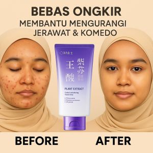 Kontrol Minyak & Hilangkan Komedo Masker Lumpur Asam Azelaic Perilla Untuk Kulit Kencang Masker Pori-Pori Dalam/Masker Perawatan Wajah Deep Cleansing/Masker Lumpur Anti Jerawat/Kulit Berminyak/Komedon