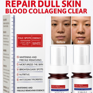 Spot Removing Serum Deep Spot Lightening Repair Serum Gentle Nourishing And Brightening Skin Tone Facial Skincare Products