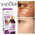 SAODER Whitening Essence Serum Remove Whiten Facial Moisturize Serum Remove Freckle Fade Dark Spot Anti-aging Whiten Facial Moisturize Serum Wajah Glowing Whitening Essence Niacinamide Skin Serum pencuci flek Removing Dark spot. 