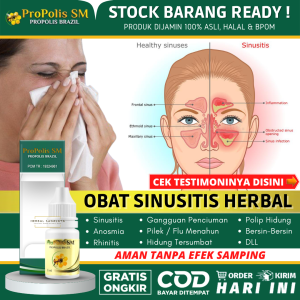 PROPOLIS SM Obat Sinusitis Herbal Alami Untuk Anak & Dewasa - Sinusitis Kronis - Sinusitis Akut - Hidung Bau Busuk - Ingus Bau Busuk - Hidung Meler - Hidung Tersumbat - Hidung Berlendir Bau Busuk - Nyeri Area Wajah - Sering Bersin - Pilek Menahun - DLL