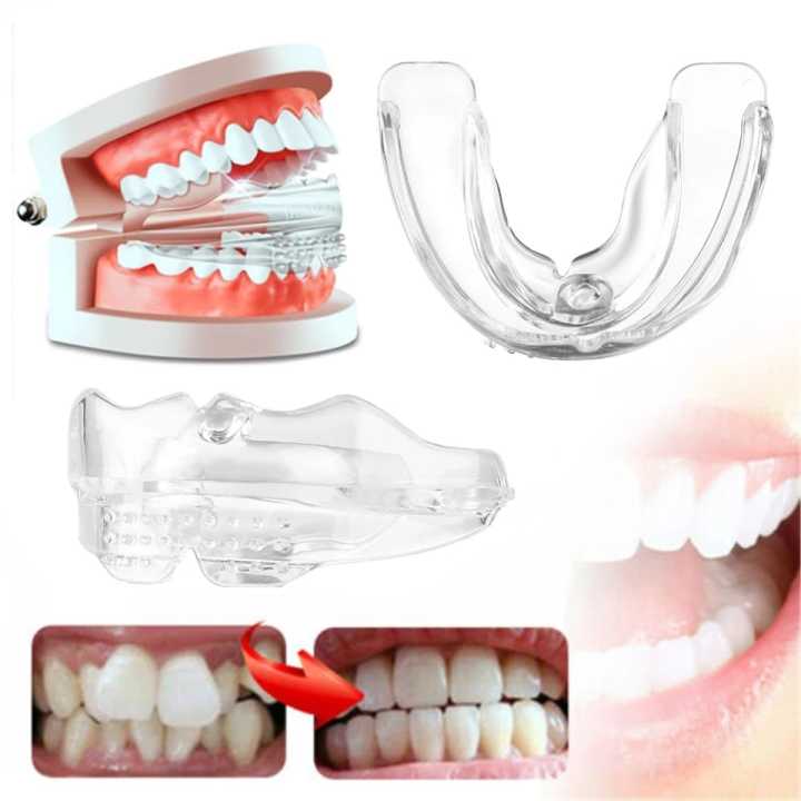 Alat untuk merapihkan gigi maju Alat perapih gigi tonggos original asli Perapih gigi maju ke depan Behel gigi lepas pasang karet murah Perapih gigi tonggos atas asli ginsul atas tidak rata asli Alat buat merapihkan gigi tonggos Teeth Trainer Alignment ORI
