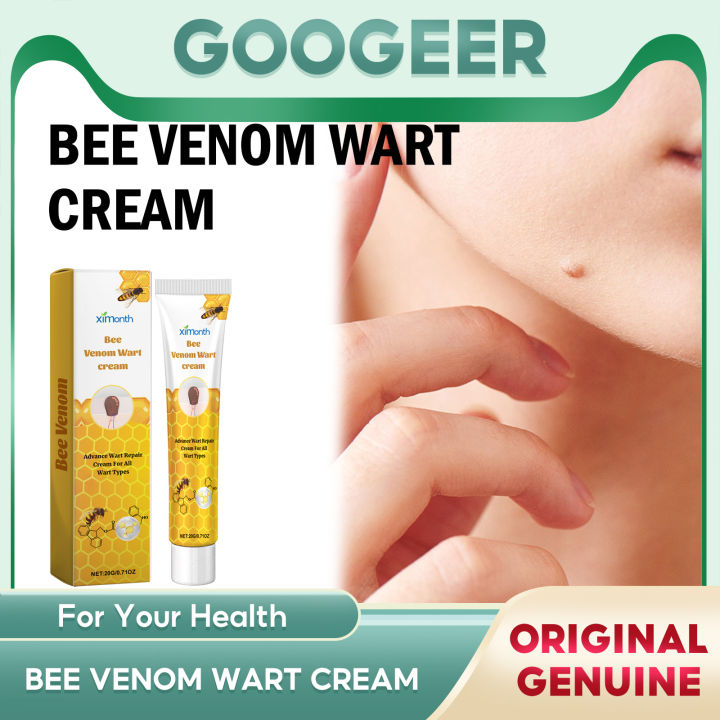 Bee Venom Skin Tag Remover Reviews Consumer Reports Ximonth Bee Venom Wart Cream Skin Tag Remover Warts Ointment Skin Tag