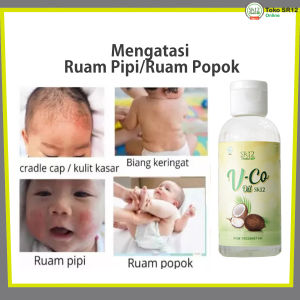 VCO 100ml Minyak Kelapa Murni Atasi Masalah Kulit Pada Bayi Ruam Popok Bruntusan Eksim Cacar Air